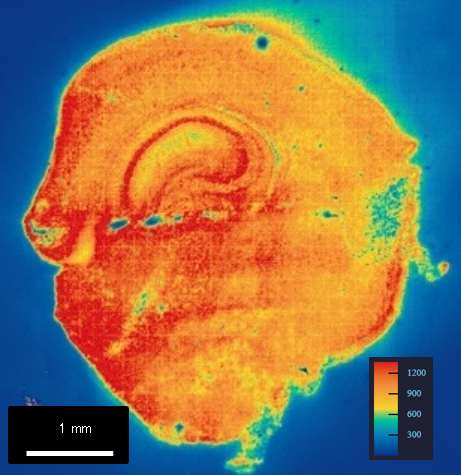 遺伝子発現プロファイル