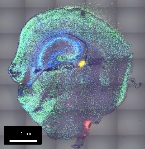 遺伝子発現プロファイル""