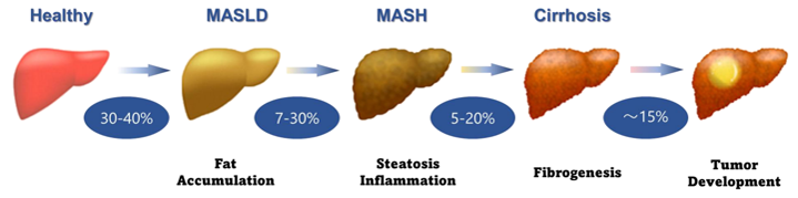 図1. 肝疾患の進行と各病態の有病率