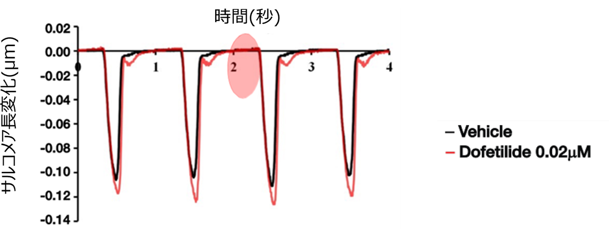 刺激に対してのサルコメア長の変化の様子