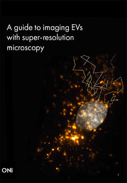 Extracellular Vesicles ガイドブック