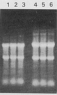 総RNAの電気泳動①