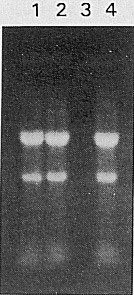 総RNAの電気泳動②