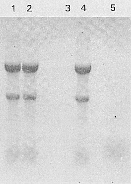 総RNAの電気泳動③
