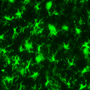免疫組織染色：ラット大脳皮質