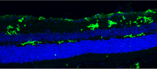 免疫組織染色：マウス網膜