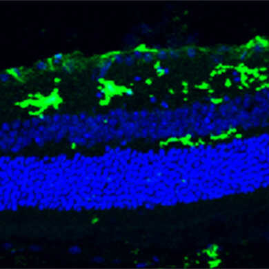 免疫組織染色：マウス 網膜