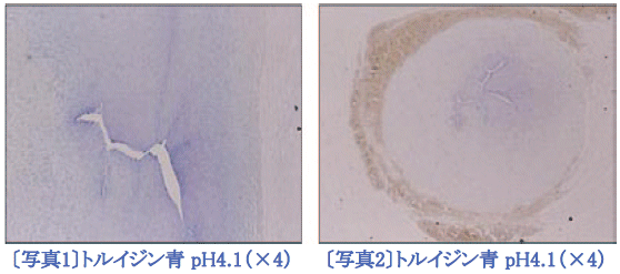 臍帯にみられる異調染色(メタクロマジー) (0.05 ％ トルイジン青 pH4.1)