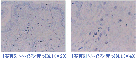 肥満細胞に存在するヘパリンのメタクロマジー(0.05 ％ トルイジン青 pH4.1)