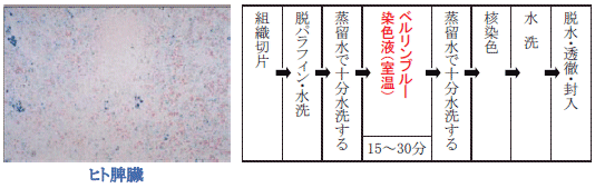 ベルリン青染色を用いたヒト脾臓染色例