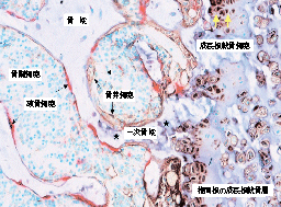 TRAP/ALP染色　染色例