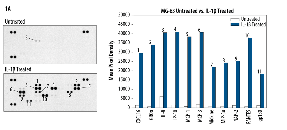 MG-63 human osteosarcoma cells were untreated or treated with 1 ng/mL recombinant human IL-1ß for 72 hours