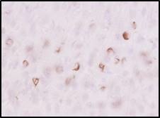 免疫組織染色　 マウス脳切片