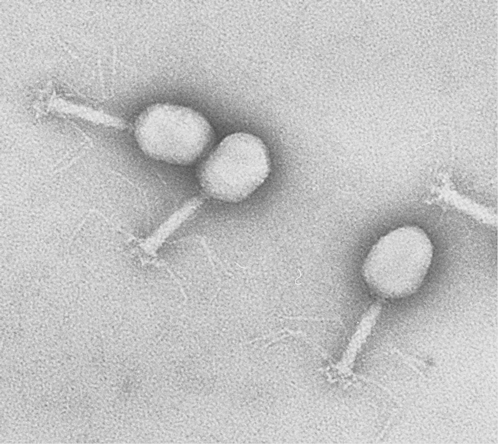 ネガティブ染色　染色例