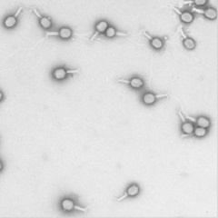 Na-Preyssler型リンタングステートカリウム塩 (0.3 wt%) 水溶液を用いたネガティブ染色例①