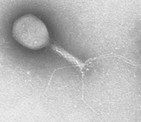 Na-Preyssler型リンタングステートカリウム塩 (0.3 wt%) 水溶液を用いたネガティブ染色例②