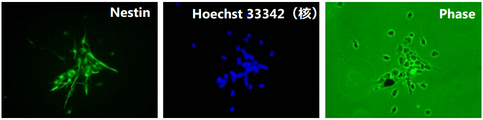 免疫細胞染色　左図：Nestin, 中央図:Hoechst 33342(核), 右図：位相差像