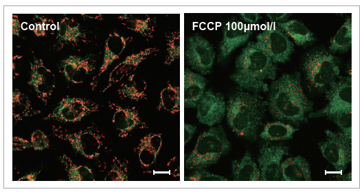 未処理の細胞では、ミトコンドリア全体が赤く染まり、FCCP で処理した細胞は赤色蛍光の減少が確認されました