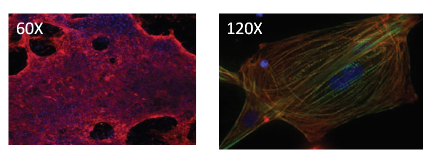 心筋細胞への分化誘導