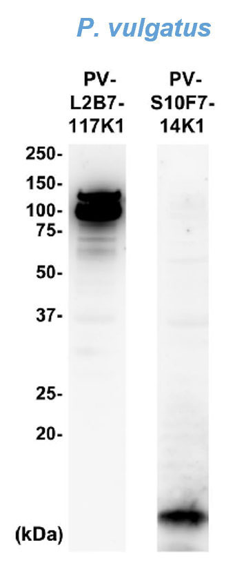 ウエスタンブロッティング