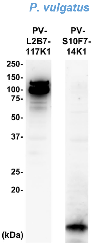 ウエスタンブロッティング