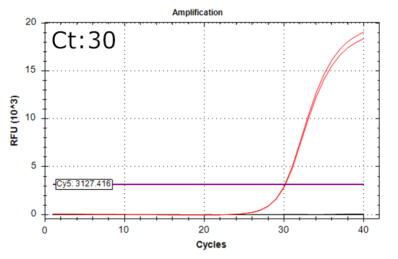 Aspergillus brasiliensis