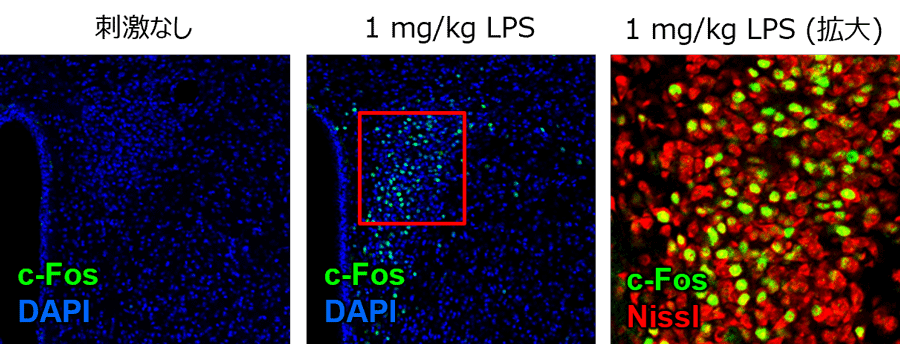 [免疫組織染色]リポポリサッカリド (LPS) 投与によるc-Fos発現の比較