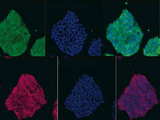 【テクニカルレポート】蛍光標識未分化マーカーレクチン rBC2LCN【AiLecS1】～未分化ヒト万能性幹細胞を生きたまま検出する～