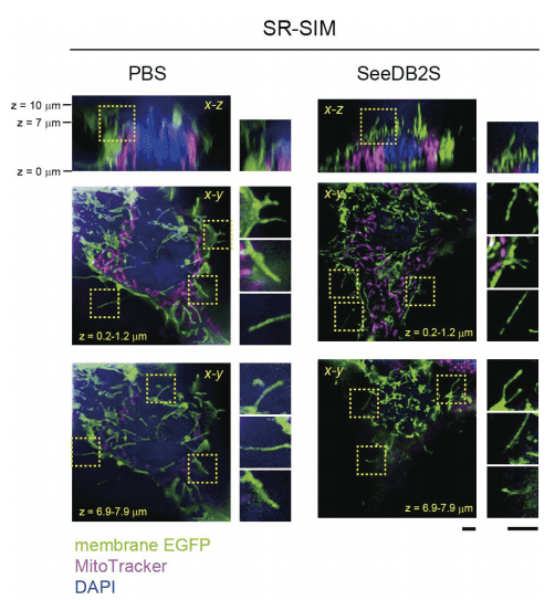 図5．SR-SIM(Zeiss社)による培養細胞(HEK293細胞)の超解像イメージング例