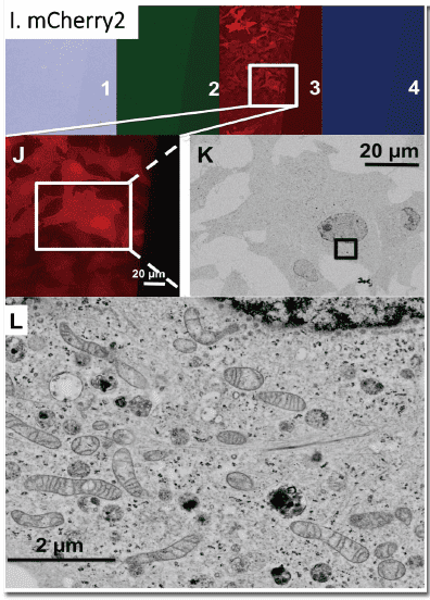 図１． CLEM-Green、mWasabi、mCherry2を用いたエポキシ樹脂包埋細胞のIn-resin CLEM