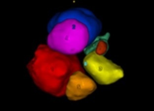 卵胞3D画像
