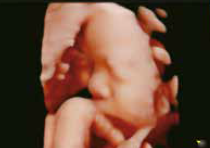 胎児4D画像