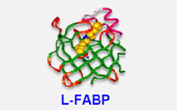 尿中L-FABPは重症患者の急性透析療法離脱の指標となる