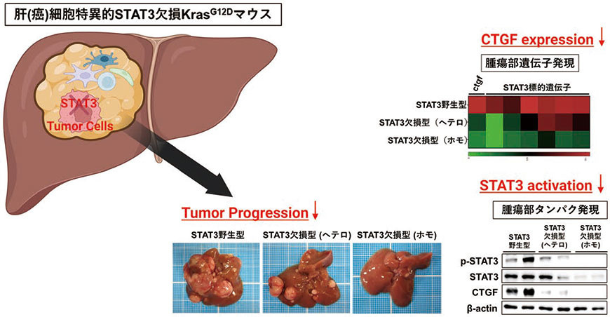 図２．肝癌細胞におけるSTAT3 の欠損による肝癌増大進展抑制
