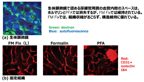 【総説】構造保持性・蛍光保持性・抗原保持性に優れた新規組織固定液―FM Fix―