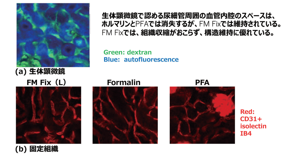 図1．FM Fixの構造保持性