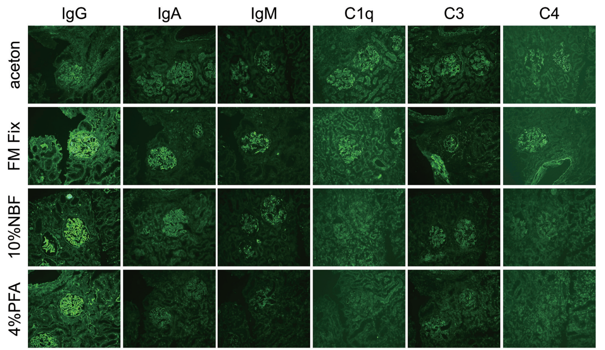 図3． FM Fixの抗原保持性