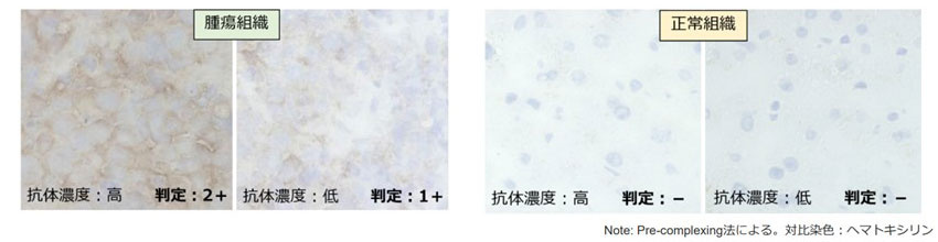 ヒト腫瘍組織において腫瘍細胞膜に発現する標的分子に対するTCR試験結果