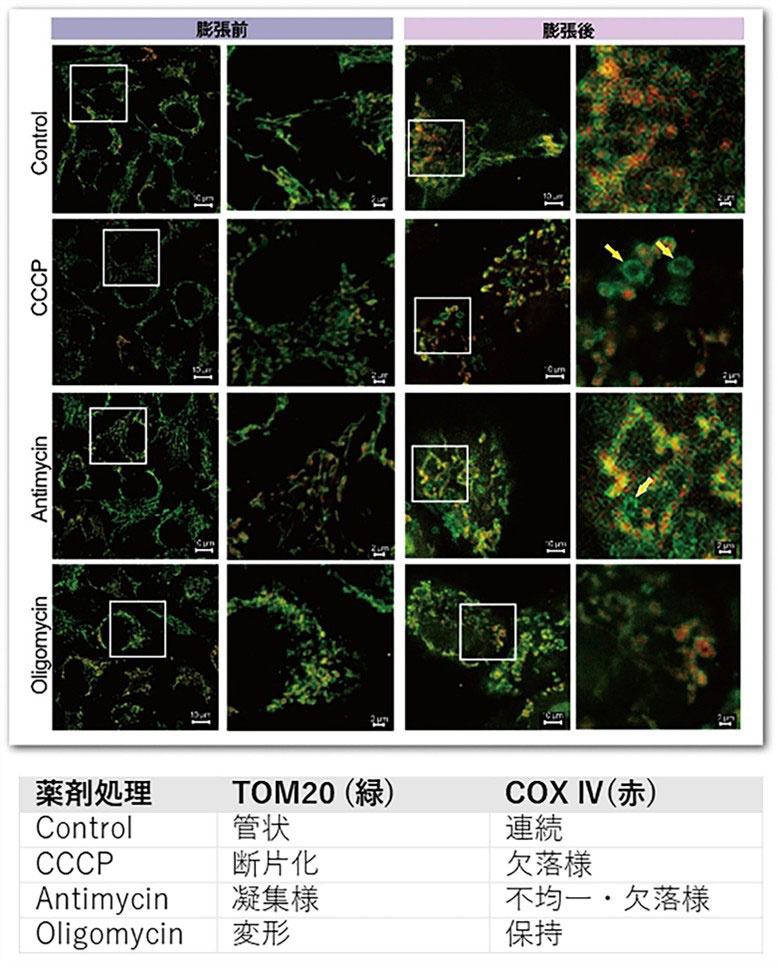図３．ExMを用いたミトコンドリアの構造変化の蛍光イメージング