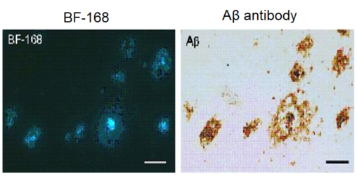 Staining image of senile plaques with fluorescent probe BF-168.