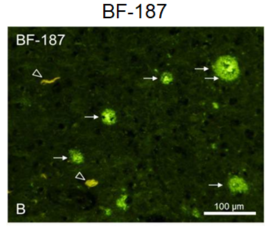 Staining image of senile plaques and neurofibrillary tangles with fluorescent probe BF-187