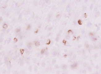 Immunostaining image of α-Synuclein Antibody