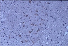 Immunostaining image of SQSTM1 antibody
