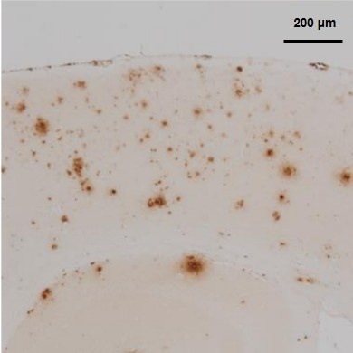 BNT77 (Dilution 1:1,000)
