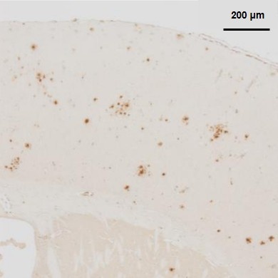 BC05 (Dilution 1:100,000)