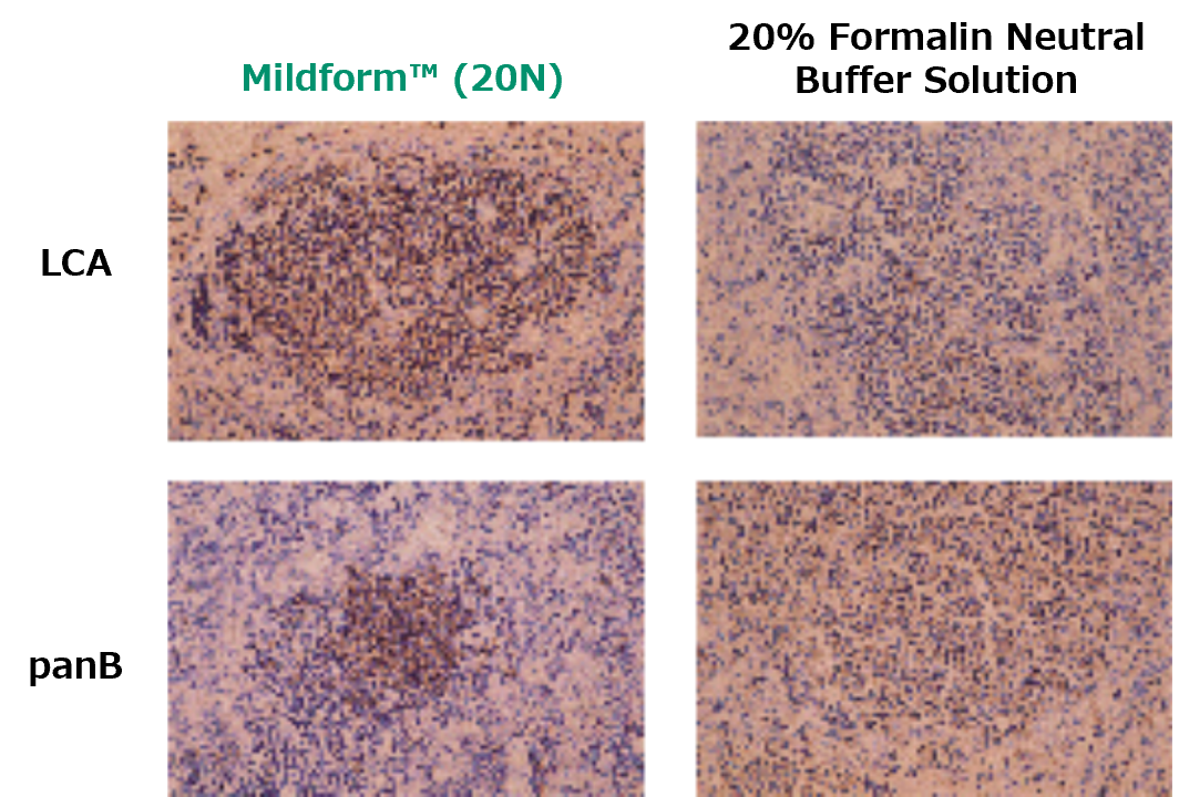 Immunohistochemistry of human lymph node tissue