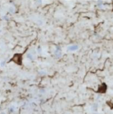 Anti Phosphorylated Tau S422, Monoclonal Antibody(AP422)