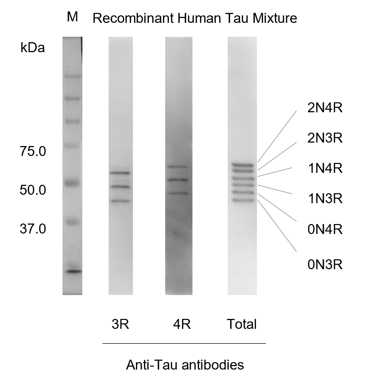 Detection of isoforms