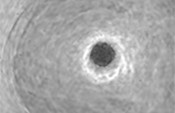 Number of Spheroids[Grade 1]