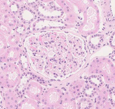 [HE] 10% Neutral buffered formalin